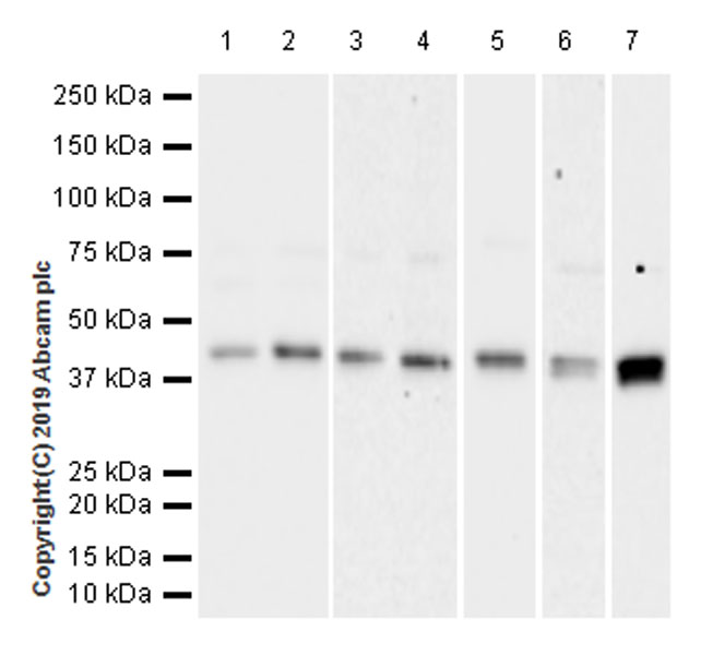 Western blot - Anti-Ataxin 3 antibody [EPR22418-147] - BSA and Azide free (AB255865)