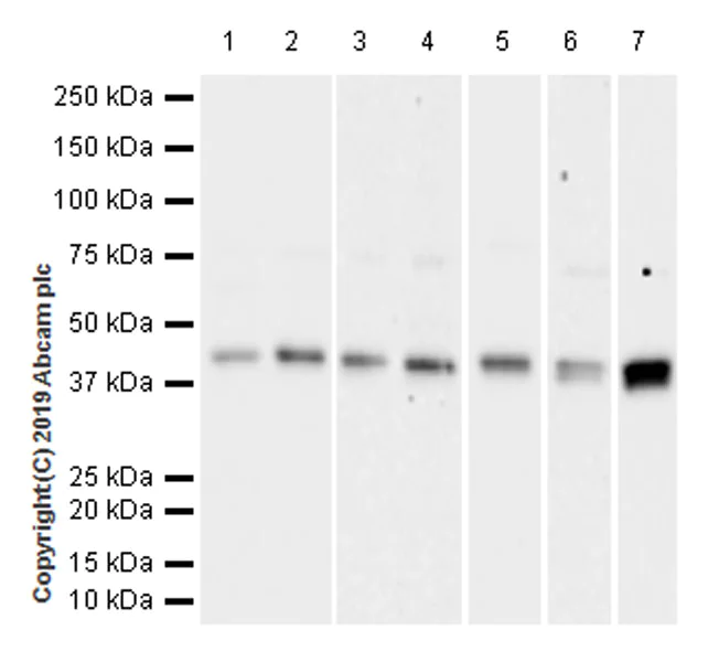 Western blot - Anti-Ataxin 3 antibody [EPR22418-147] - BSA and Azide free (AB255865)