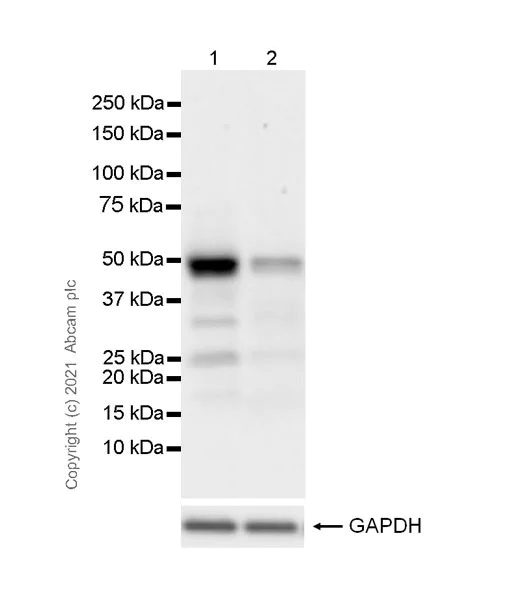 Western blot - Anti-Ataxin 3 antibody [EPR24153-2] (AB259828)