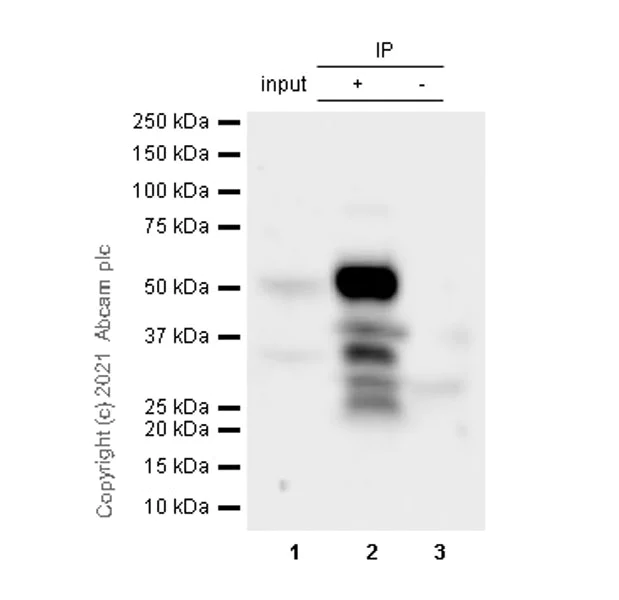Immunoprecipitation - Anti-Ataxin 3 antibody [EPR24153-2] - BSA and Azide free (AB284865)