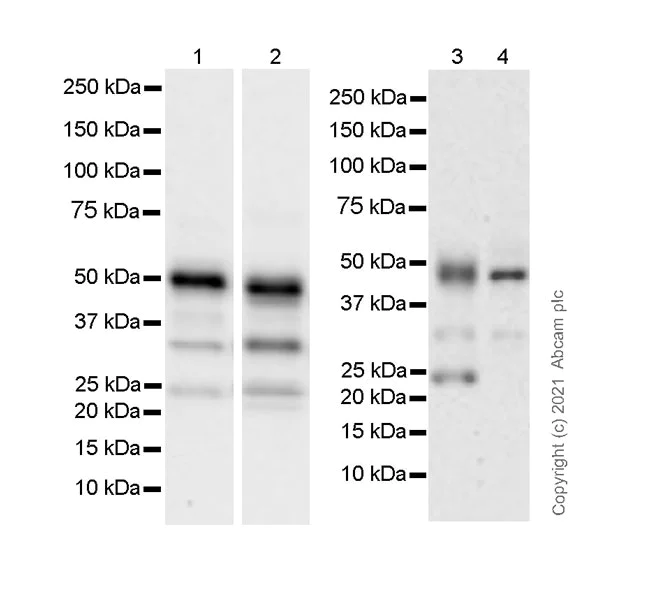 Western blot - Anti-Ataxin 3 antibody [EPR24153-2] - BSA and Azide free (AB284865)