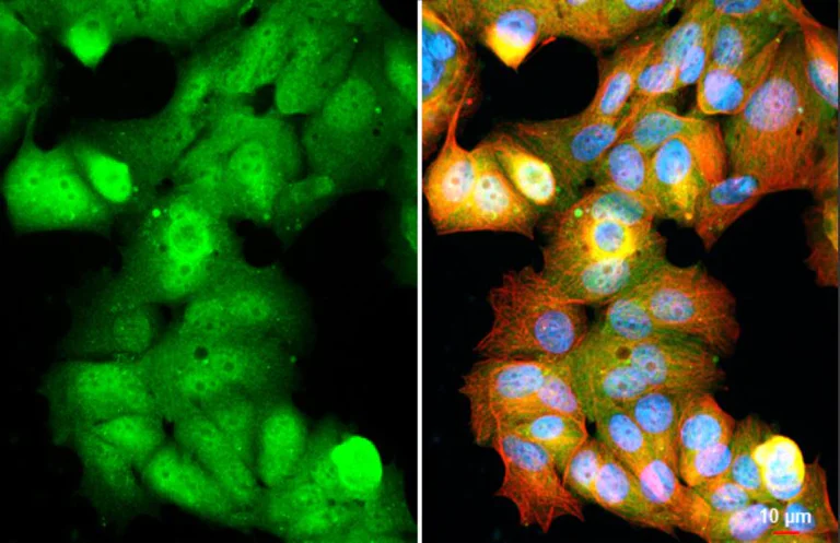 Immunocytochemistry/ Immunofluorescence - Anti-Ataxin 3 antibody [HL1909] (AB308203)