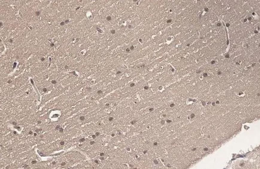Immunohistochemistry (Formalin/PFA-fixed paraffin-embedded sections) - Anti-Ataxin 3 antibody [HL1909] (AB308203), expandable thumbnail