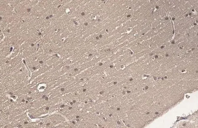 Immunohistochemistry (Formalin/PFA-fixed paraffin-embedded sections) - Anti-Ataxin 3 antibody [HL1909] (AB308203)