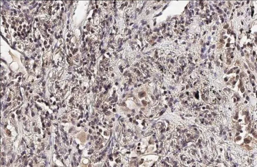 Immunohistochemistry (Formalin/PFA-fixed paraffin-embedded sections) - Anti-Ataxin 3 antibody [HL1909] (AB308203), expandable thumbnail