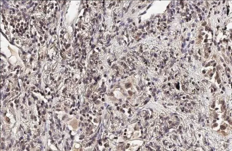 Immunohistochemistry (Formalin/PFA-fixed paraffin-embedded sections) - Anti-Ataxin 3 antibody [HL1909] (AB308203)