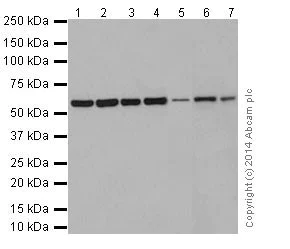 Western blot - Anti-ATE1 antibody [EPR13667(2)] - N-terminal (AB199423)