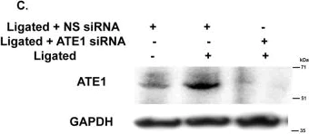 Western blot - Anti-ATE1 antibody [EPR13667(2)] - N-terminal (AB199423)