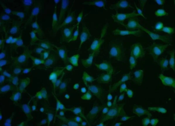 Immunocytochemistry/ Immunofluorescence - Anti-ATF-4 antibody (AB216839)