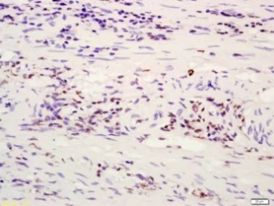 Immunohistochemistry (Formalin/PFA-fixed paraffin-embedded sections) - Anti-ATF-4 antibody (AB216839)