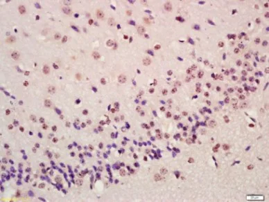 Immunohistochemistry (Formalin/PFA-fixed paraffin-embedded sections) - Anti-ATF-4 antibody (AB216839)