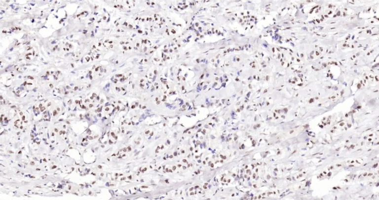 Immunohistochemistry (Formalin/PFA-fixed paraffin-embedded sections) - Anti-ATF-4 antibody (AB216839)
