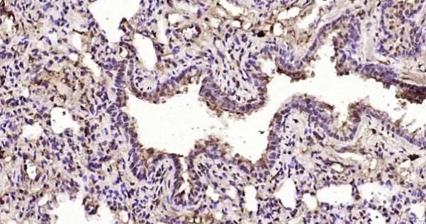 Immunohistochemistry (Formalin/PFA-fixed paraffin-embedded sections) - Anti-ATF-4 antibody (AB216839)