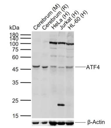 おまとめ【aph19】【fl245】【cal64】 Alexa Fluor™ 647-Labeled Monoclonal Anti-FMC63 Antibody