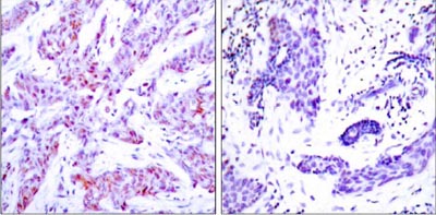 Immunohistochemistry (Formalin/PFA-fixed paraffin-embedded sections) - Anti-ATF-4 antibody (AB31390)