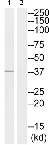 Western blot - Anti-ATF-4 (phospho S219) antibody (AB192580)