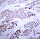 Immunohistochemistry (Formalin/PFA-fixed paraffin-embedded sections) - Anti-ATF-4 (phospho S245) antibody (AB28830)