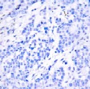 Immunohistochemistry (Formalin/PFA-fixed paraffin-embedded sections) - Anti-ATF-4 (phospho S245) antibody (AB28830)