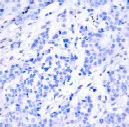 Immunohistochemistry (Formalin/PFA-fixed paraffin-embedded sections) - Anti-ATF-4 (phospho S245) antibody (AB28830)