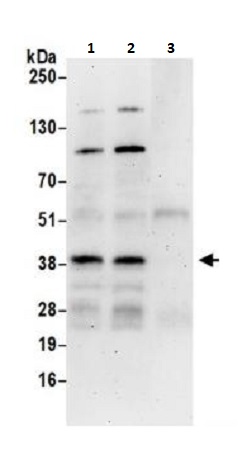 Immunoprecipitation - Anti-ATF1 antibody (AB264316), expandable thumbnail