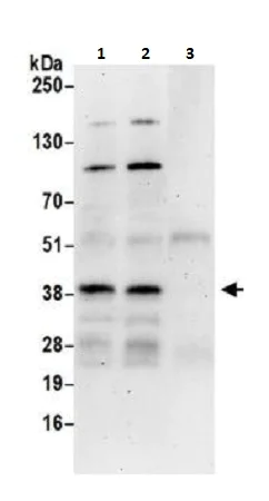 Immunoprecipitation - Anti-ATF1 antibody (AB264316)
