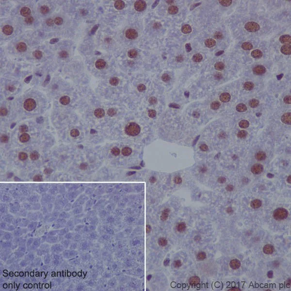 Immunohistochemistry (Formalin/PFA-fixed paraffin-embedded sections) - Anti-ATF1 antibody [EPR17028] (AB181569)