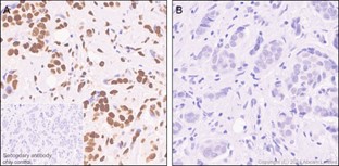 Immunohistochemistry (Formalin/PFA-fixed paraffin-embedded sections) - Anti-ATF1 (phospho S63) antibody [EP1591(2)Y] (AB76085), expandable thumbnail