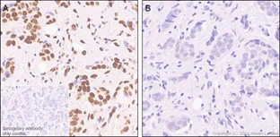 Immunohistochemistry (Formalin/PFA-fixed paraffin-embedded sections) - Anti-ATF1 (phospho S63) antibody [EP1591(2)Y] (AB76085)