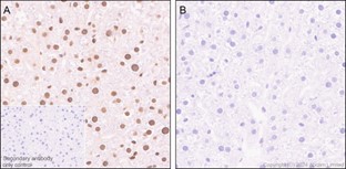 Immunohistochemistry (Formalin/PFA-fixed paraffin-embedded sections) - Anti-ATF1 (phospho S63) antibody [EP1591(2)Y] (AB76085), expandable thumbnail