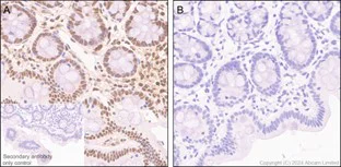 Immunohistochemistry (Formalin/PFA-fixed paraffin-embedded sections) - Anti-ATF1 (phospho S63) antibody [EP1591(2)Y] (AB76085)