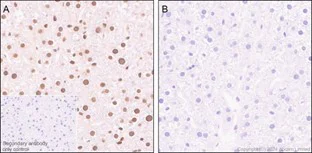 Immunohistochemistry (Formalin/PFA-fixed paraffin-embedded sections) - Anti-ATF1 (phospho S63) antibody [EP1591(2)Y] - BSA and Azide free (AB284738)