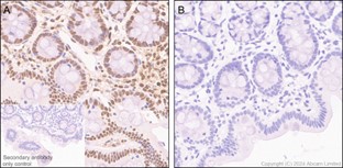 Immunohistochemistry (Formalin/PFA-fixed paraffin-embedded sections) - Anti-ATF1 (phospho S63) antibody [EP1591(2)Y] - BSA and Azide free (AB284738), expandable thumbnail