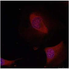 Immunocytochemistry/ Immunofluorescence - Anti-ATF2 antibody (AB131484)