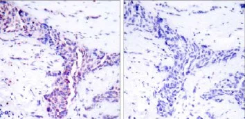 Immunohistochemistry (Formalin/PFA-fixed paraffin-embedded sections) - Anti-ATF2 antibody (AB31483)