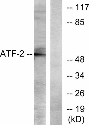 Western blot - Anti-ATF2 antibody (AB31483)