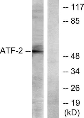 Western blot - Anti-ATF2 antibody (AB31483)