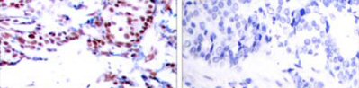 Immunohistochemistry (Formalin/PFA-fixed paraffin-embedded sections) - Anti-ATF2 antibody (AB47476)