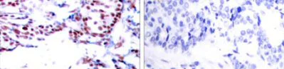Immunohistochemistry (Formalin/PFA-fixed paraffin-embedded sections) - Anti-ATF2 antibody (AB47476)