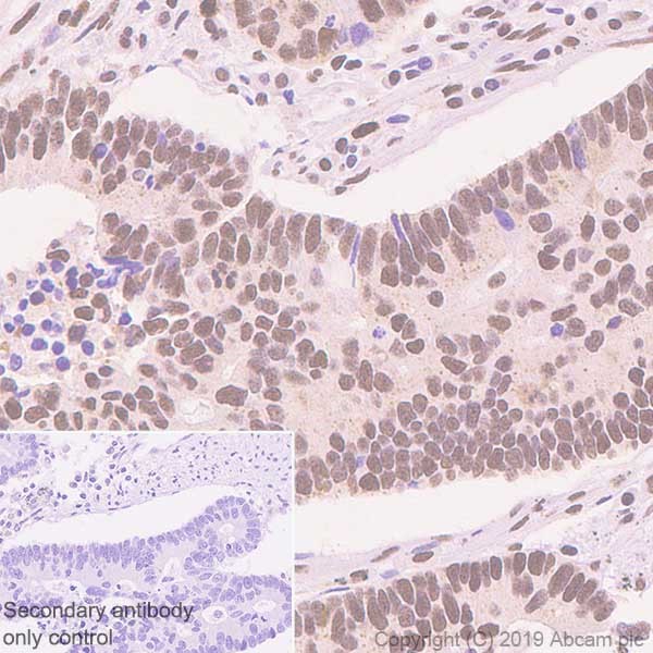 Immunohistochemistry (Formalin/PFA-fixed paraffin-embedded sections) - Anti-ATF2 antibody [E242] (AB32061)