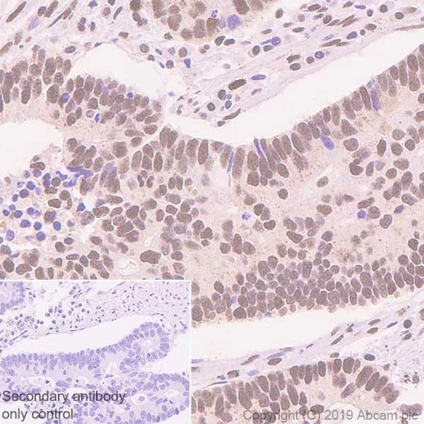 Immunohistochemistry (Formalin/PFA-fixed paraffin-embedded sections) - Anti-ATF2 antibody [E242] - BSA and Azide free (AB284666)