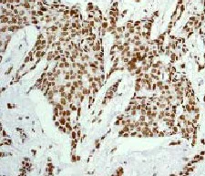 Immunohistochemistry (Formalin/PFA-fixed paraffin-embedded sections) - Anti-ATF2 antibody [E243] - BSA and Azide free (AB247240)