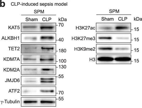 Western blot - Anti-ATF2 antibody [E243] - ChIP Grade (AB32160)