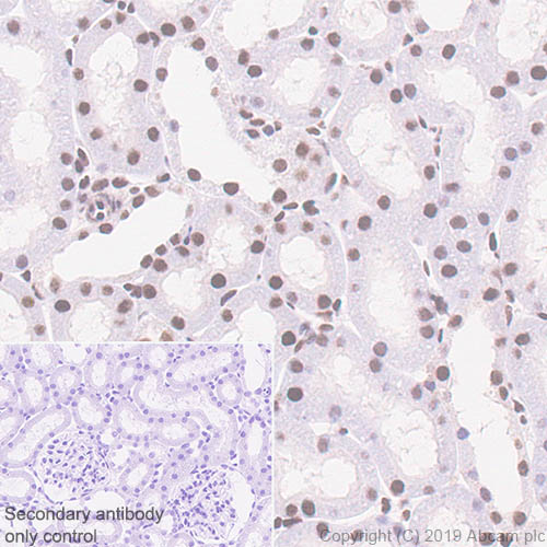 Immunohistochemistry (Formalin/PFA-fixed paraffin-embedded sections) - Anti-ATF2 antibody [EPR22938-114] (ab239361), expandable thumbnail