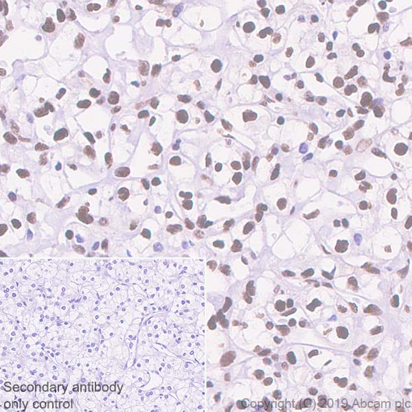 Immunohistochemistry (Formalin/PFA-fixed paraffin-embedded sections) - Anti-ATF2 antibody [EPR22938-114] (ab239361), expandable thumbnail
