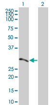 Western blot - ATF2 overexpression 293T lysate (whole cell) (AB94192), expandable thumbnail