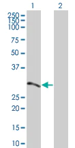 Western blot - ATF2 overexpression 293T lysate (whole cell) (AB94192)
