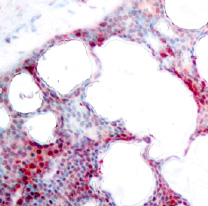 Immunohistochemistry (Formalin/PFA-fixed paraffin-embedded sections) - Anti-ATF2 (phospho S62 + S44) antibody (AB28847), expandable thumbnail