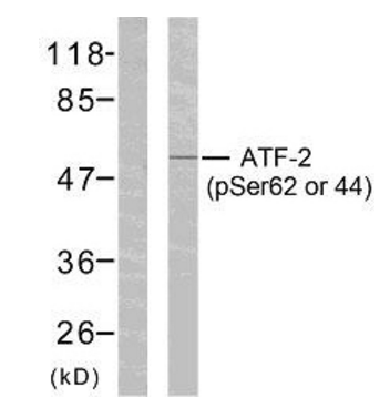 Western blot - Anti-ATF2 (phospho S62 + S44) antibody (AB28847), expandable thumbnail