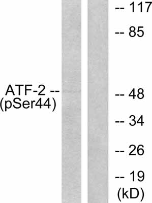 Western blot - Anti-ATF2 (phospho S62 + S44) antibody (AB28847), expandable thumbnail