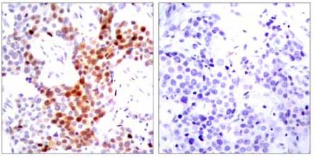 Immunohistochemistry (Formalin/PFA-fixed paraffin-embedded sections) - Anti-ATF2 (phospho T51 + T69) antibody (AB131106)
